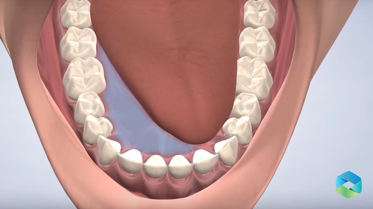 Oral Pathology in Mount Pleasant SC |Oral Surgery & Dental Implant Specialists South Carolina