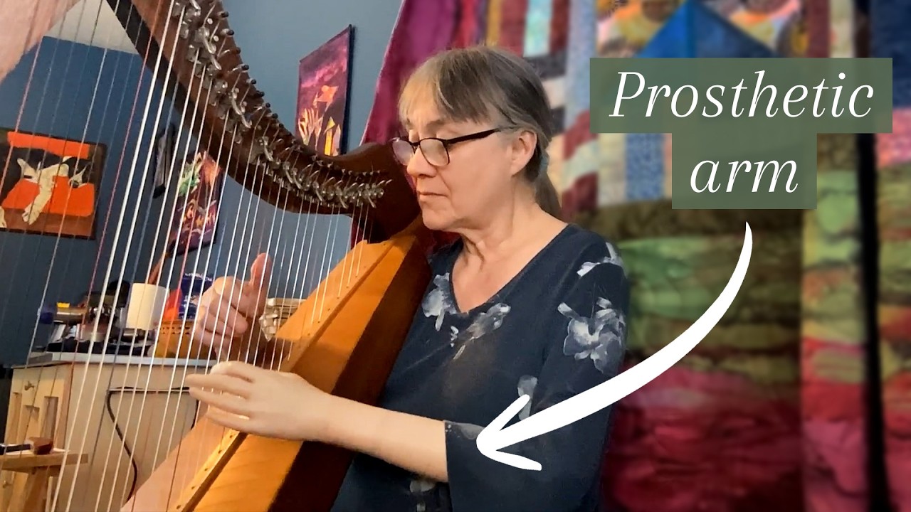 Learning Harp With a Prosthetic Arm