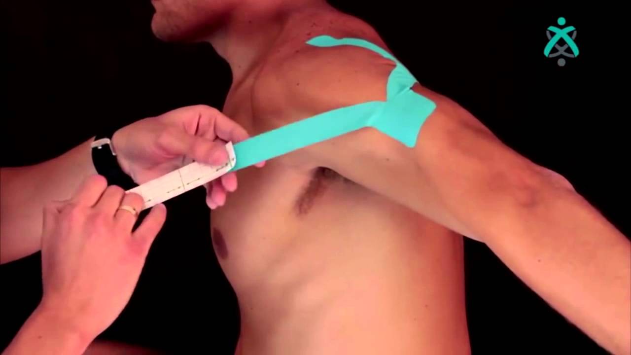 Como aplicar a bandagem Kinesio para estabilizar o ombro