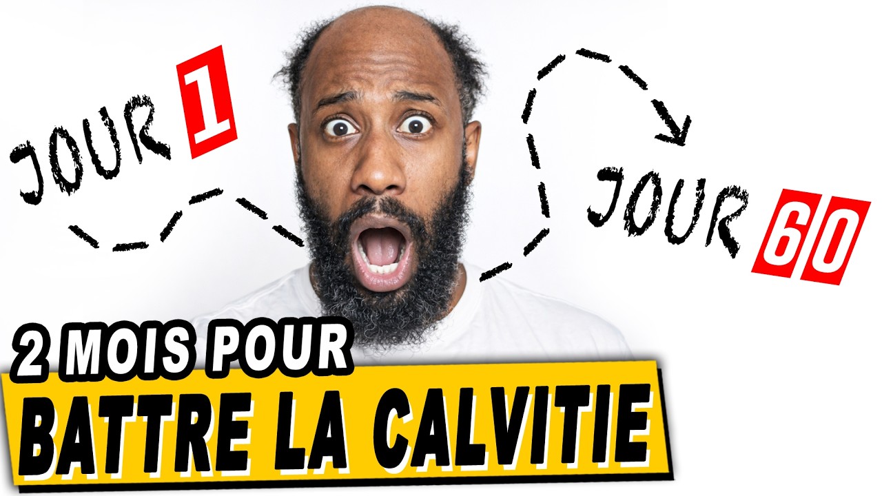 2 MOIS pour en finir avec la CALVITIE