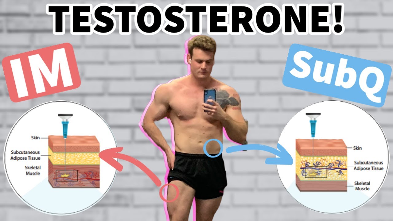 IM Vs SubQ Testosterone Injections? Is SubQ Better? Doctor's Analysis