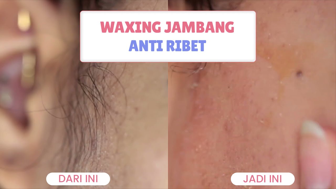 WAXING JAMBANG ANTI RIBET DENGAN MIRAEL SUGAR WAX