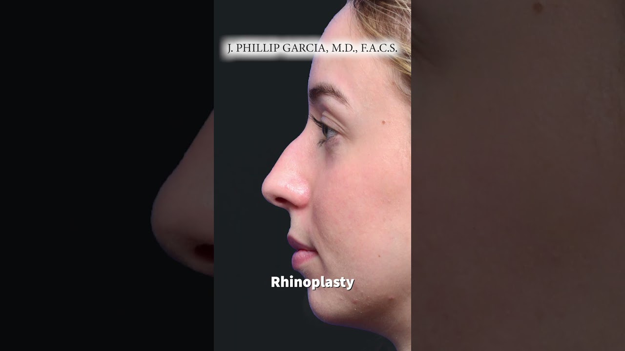 How Long Does Facial Plastic Surgery Last?