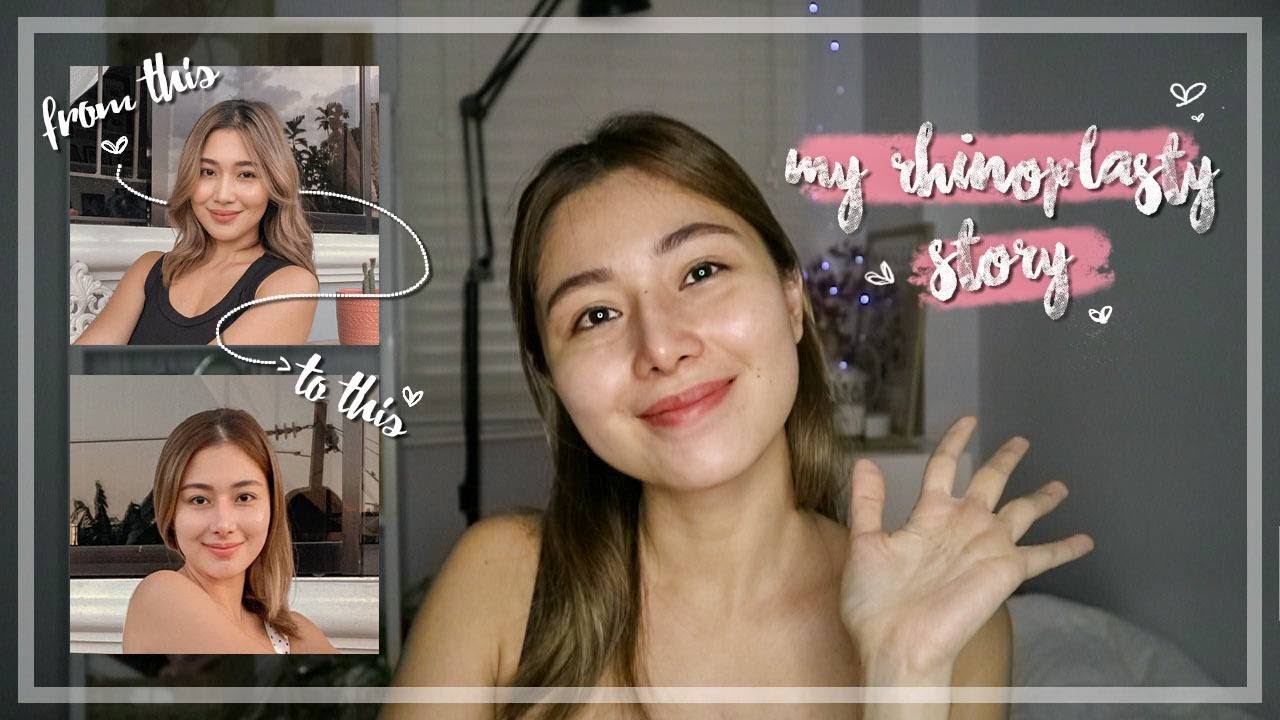 My Rhinoplasty Story | Kath Figuracion