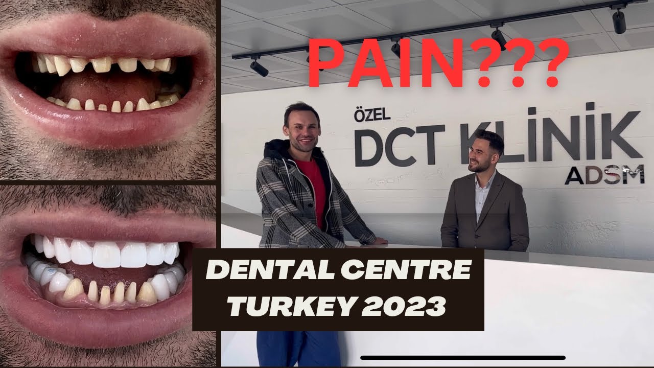 Full smile makeover in Turkey 2023 | Dental centre Turkey