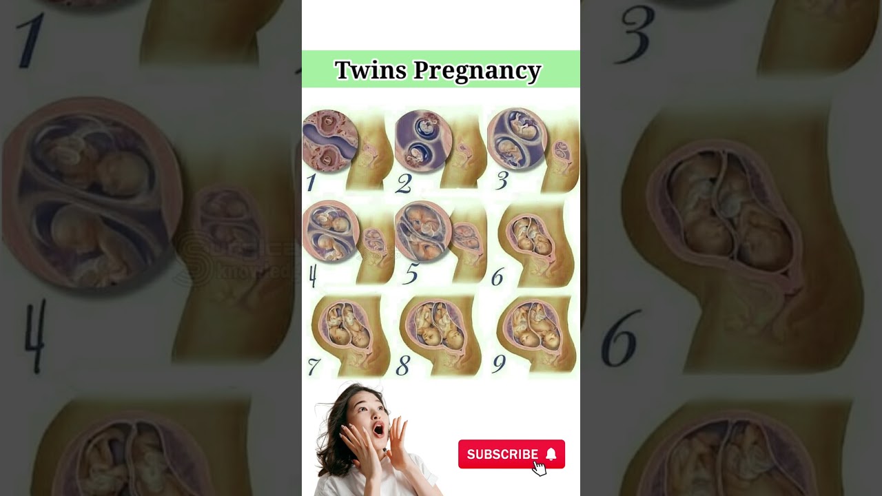 Twins Pregnancy #twins #pregnancy #pregnancyjourney #pregnancyweekbyweek