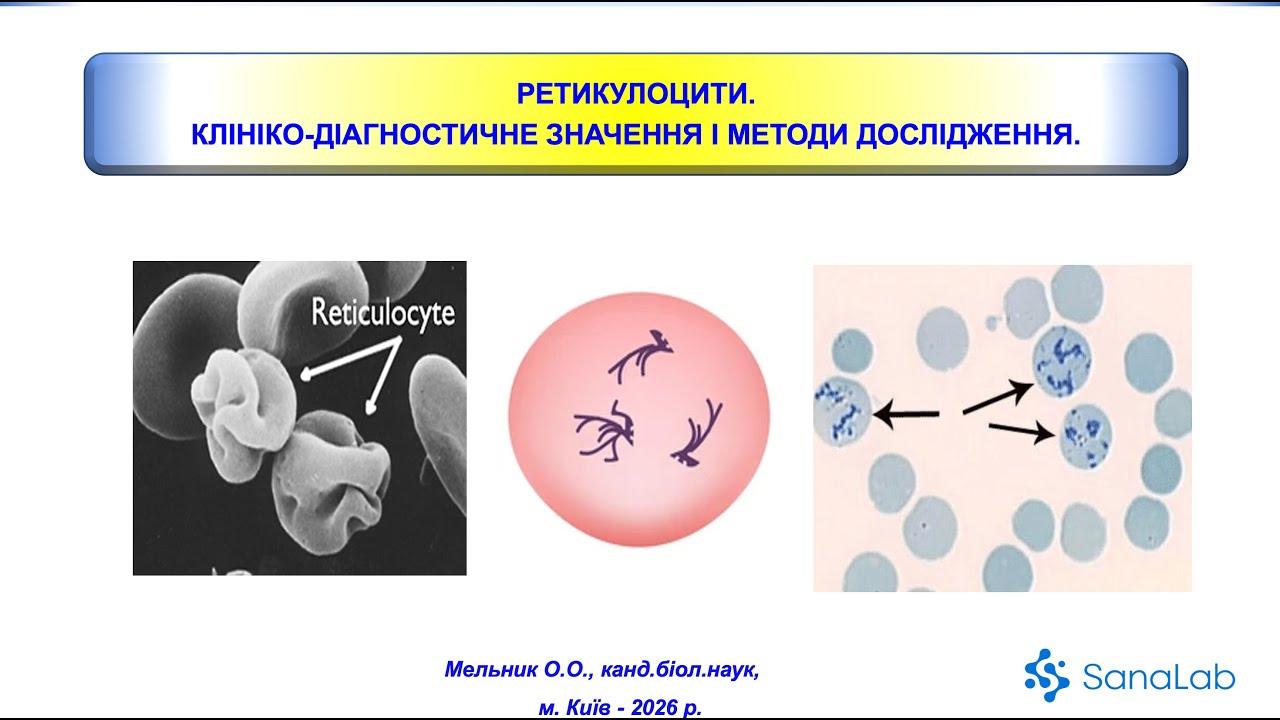 Ретикулоцити. Клініко-діагностичне значення і методи дослідження