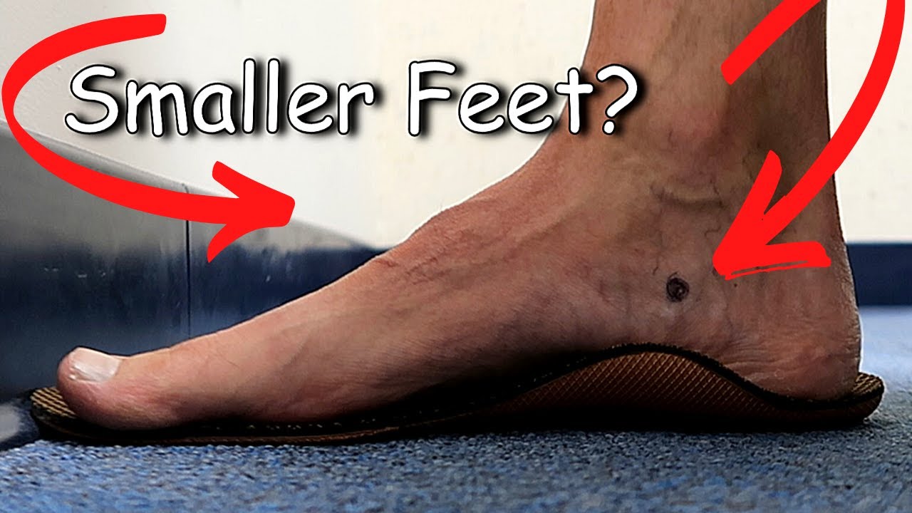 Reducing the LENGTH of your FEET