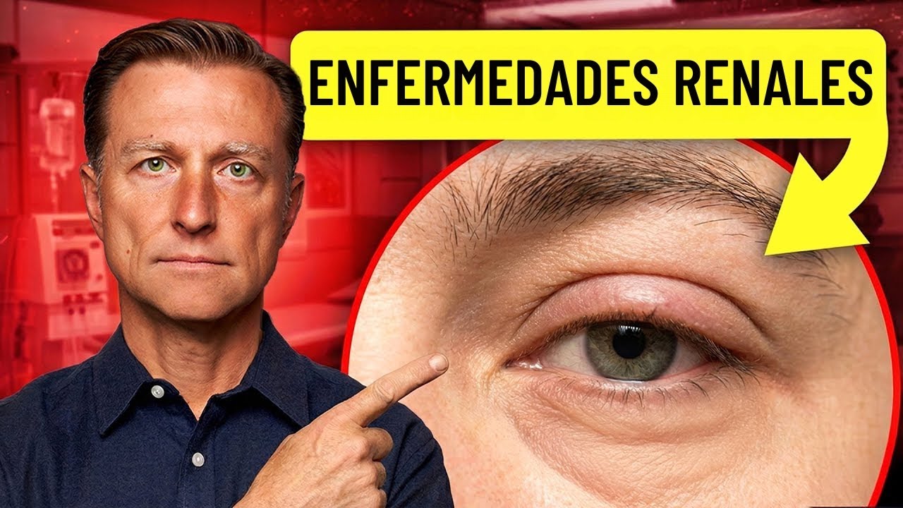 18 señales visibles de enfermedad renal que no debes ignorar