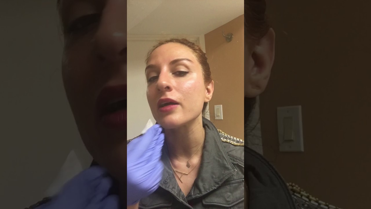 Microneedling with AquaGold