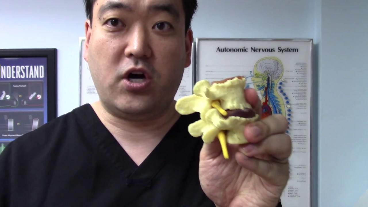 NYC Doctor Shares Solution for Failed Back Surgery Syndrome