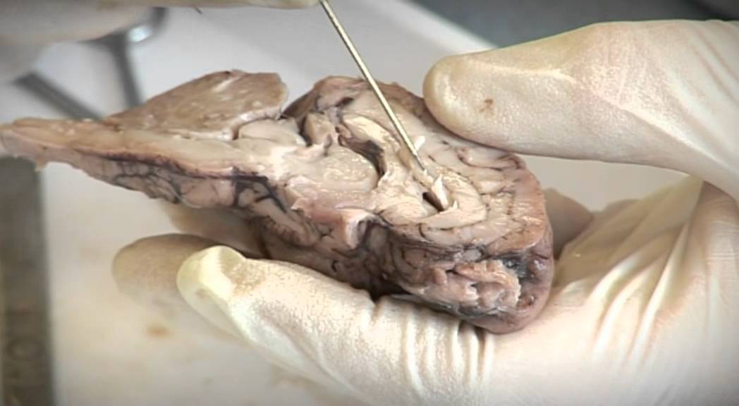Sheep Brain Dissection