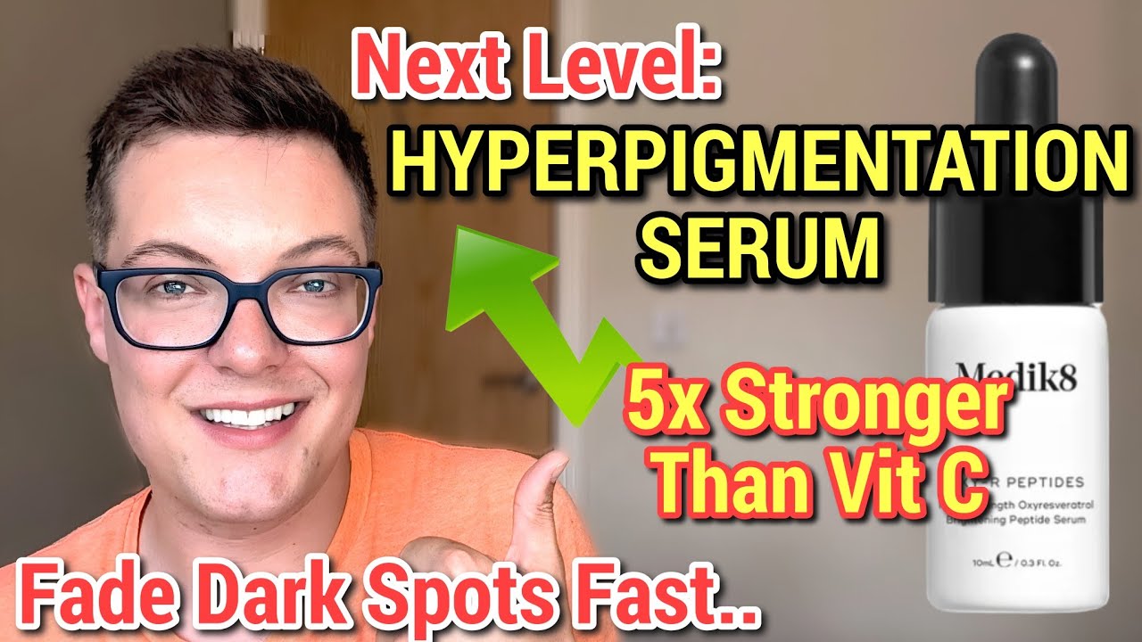 MOVE OVER VITAMIN C - This Hyperpigmentation Serum Blew Me Away