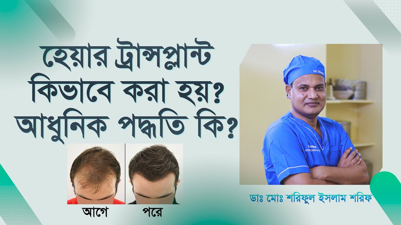হেয়ার ট্রান্সপ্লান্ট কি? কিভাবে করা হয়? Hair Transplants and Treatment 2022