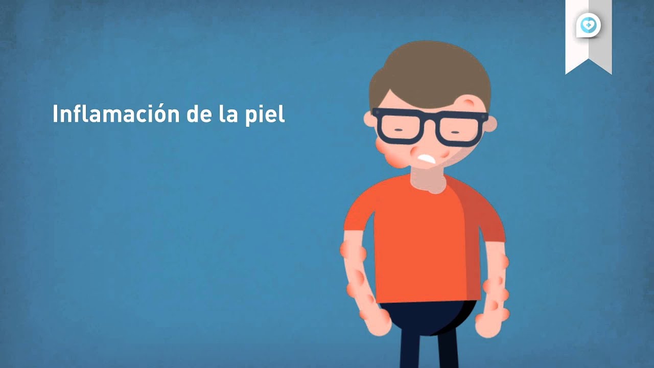 Tipos de alergias
