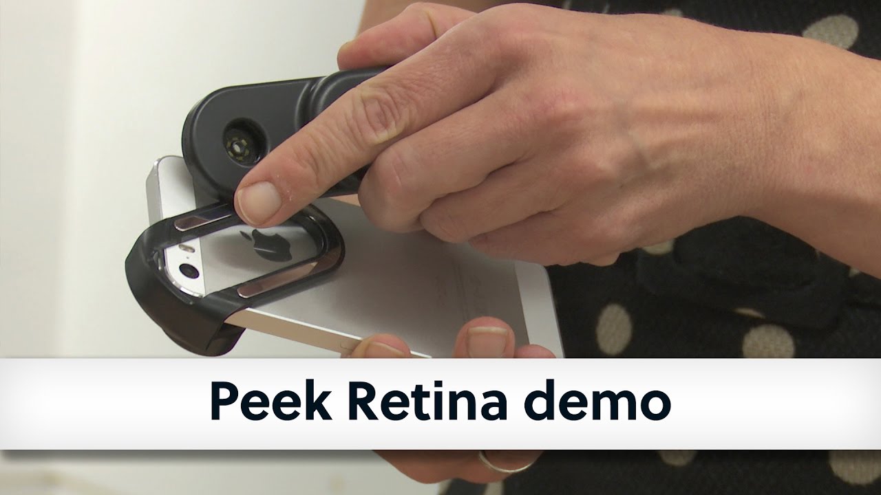 Peek Retina demo