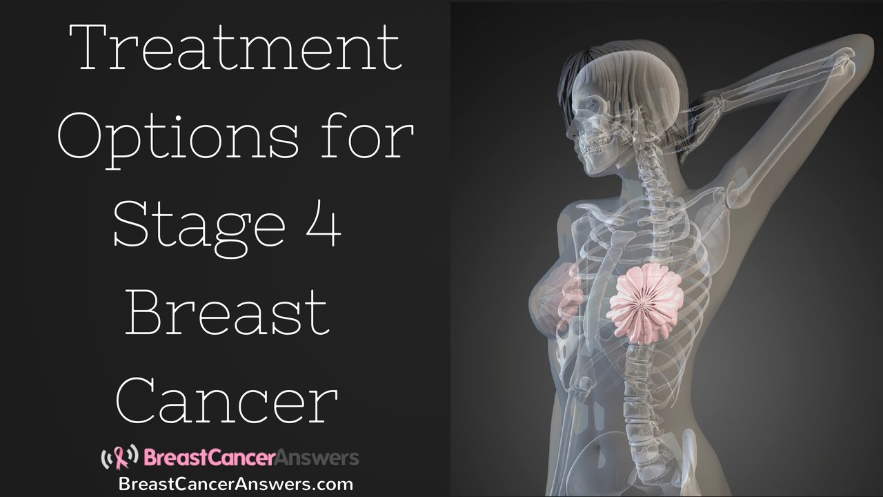 What Are the Treatment Options for Stage 4 Breast Cancer?