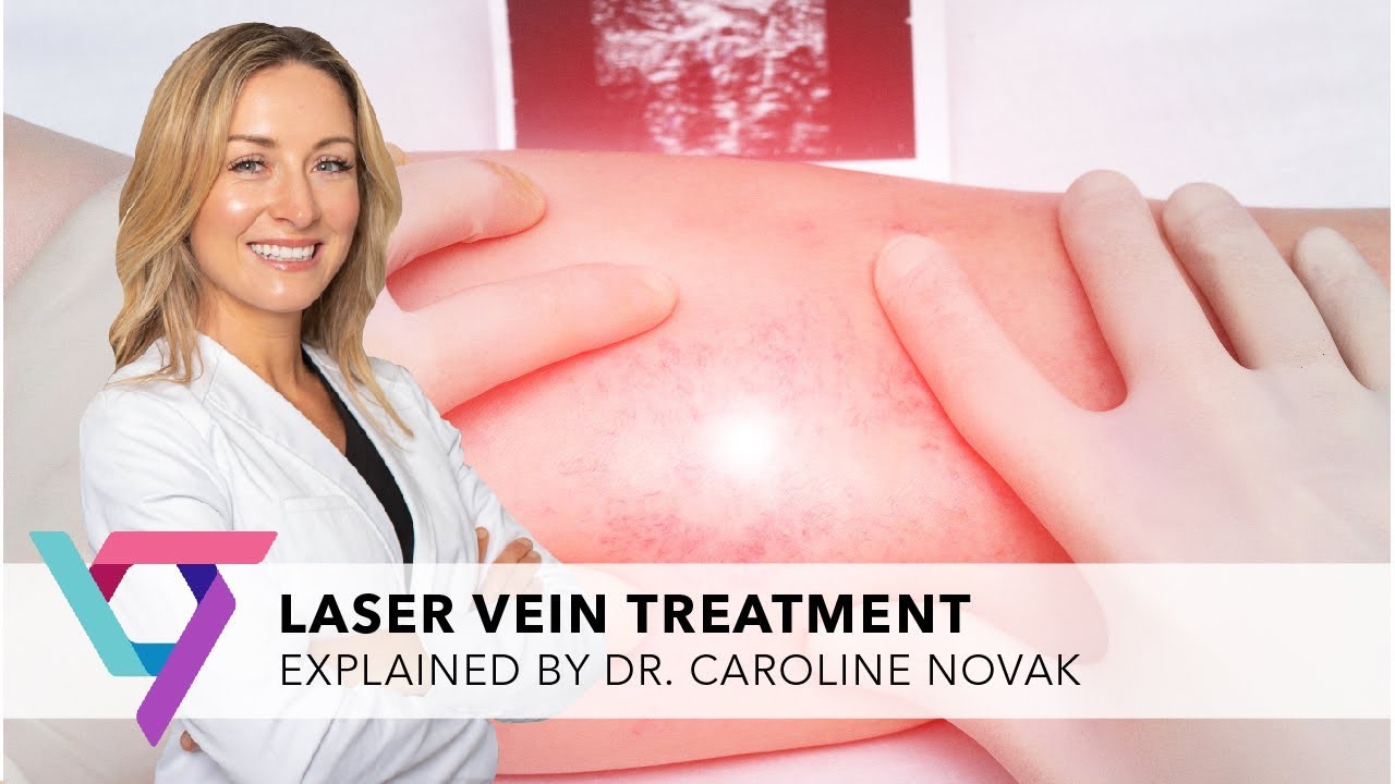 Medical Center: Laser Vein Treatment with Dr. Novak. Vein Center, Manhattan 10017