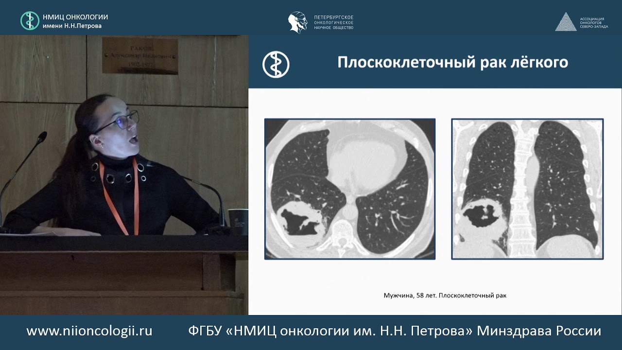 Лучевая диагностика немелкоклеточного рака легкого