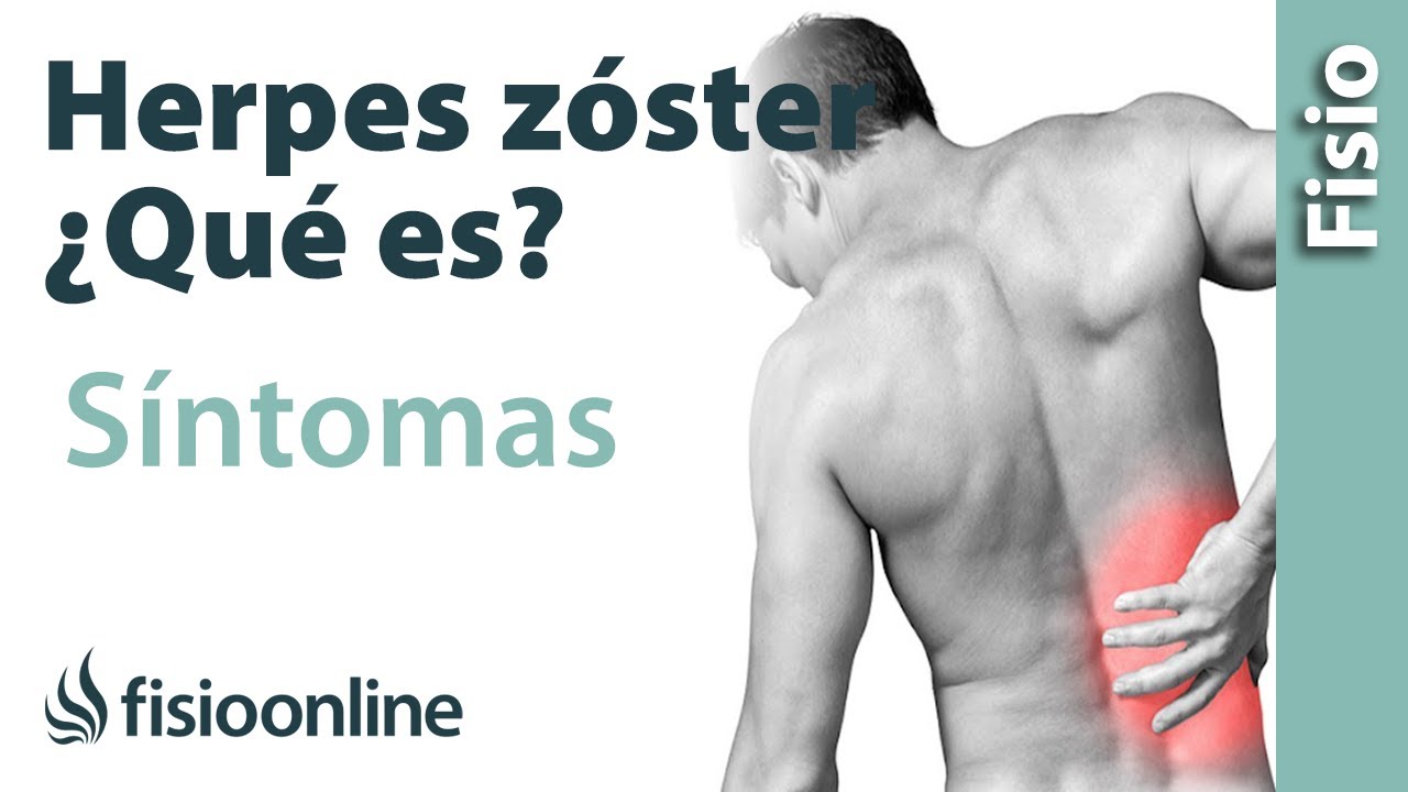 HERPES ZÓSTER | Qué es, qué estructuras afecta, síntomas, signos, causas y tratamiento