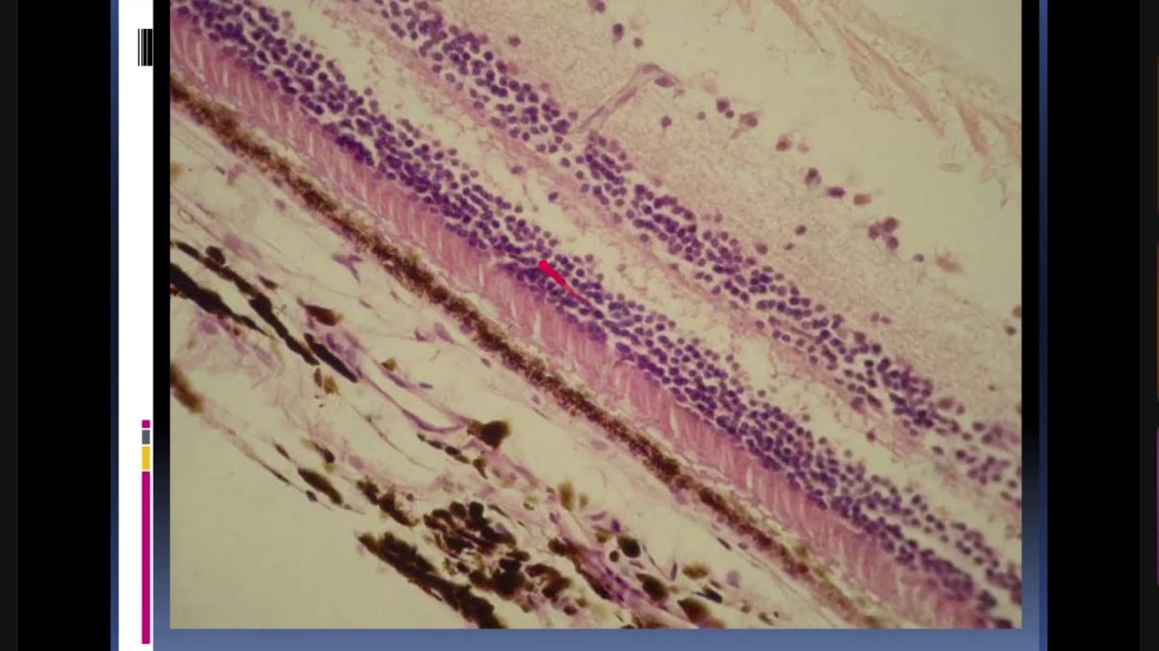 PARALELO DE HISTOLOGÍA- SISTEMA NERVIOSO. RECEPTORES (OJO)