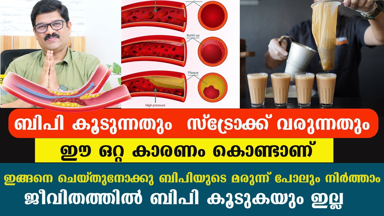 ബിപി കൂടാനും സ്‌ട്രോക്ക്‌ വരാനും കാരണം നാം ചെയ്യുന്ന ഈ തെറ്റാണ് ഇങ്ങനെ ഒരാഴ്ച ചെയ്താൽ നോർമൽ ആകും