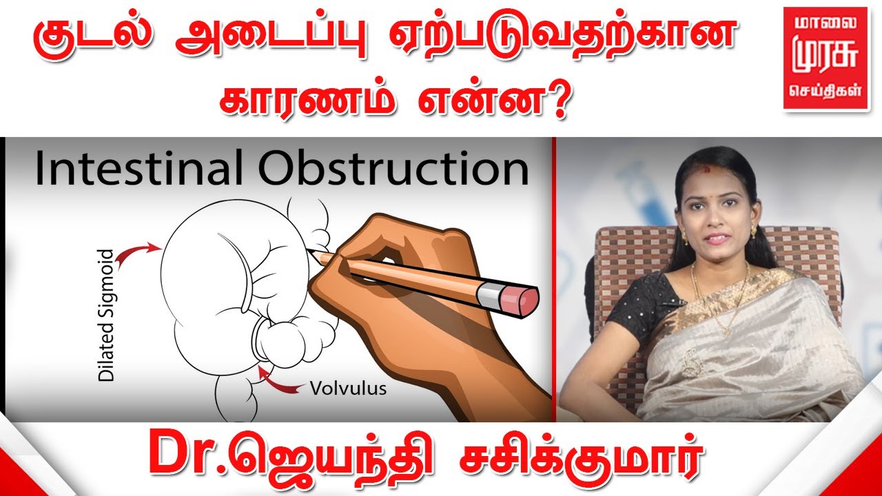 குடல் அடைப்பு குறித்து விளக்குகிறார் மருத்துவர் ஜெயந்தி சசிக்குமார் | Intestinal obstruction