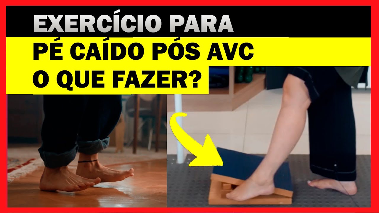 DIFICULDADE DE APOIAR O PÉ NO CHÃO DEPOIS DO AVC, Uma dica de Exercício para PÉ CAÍDO