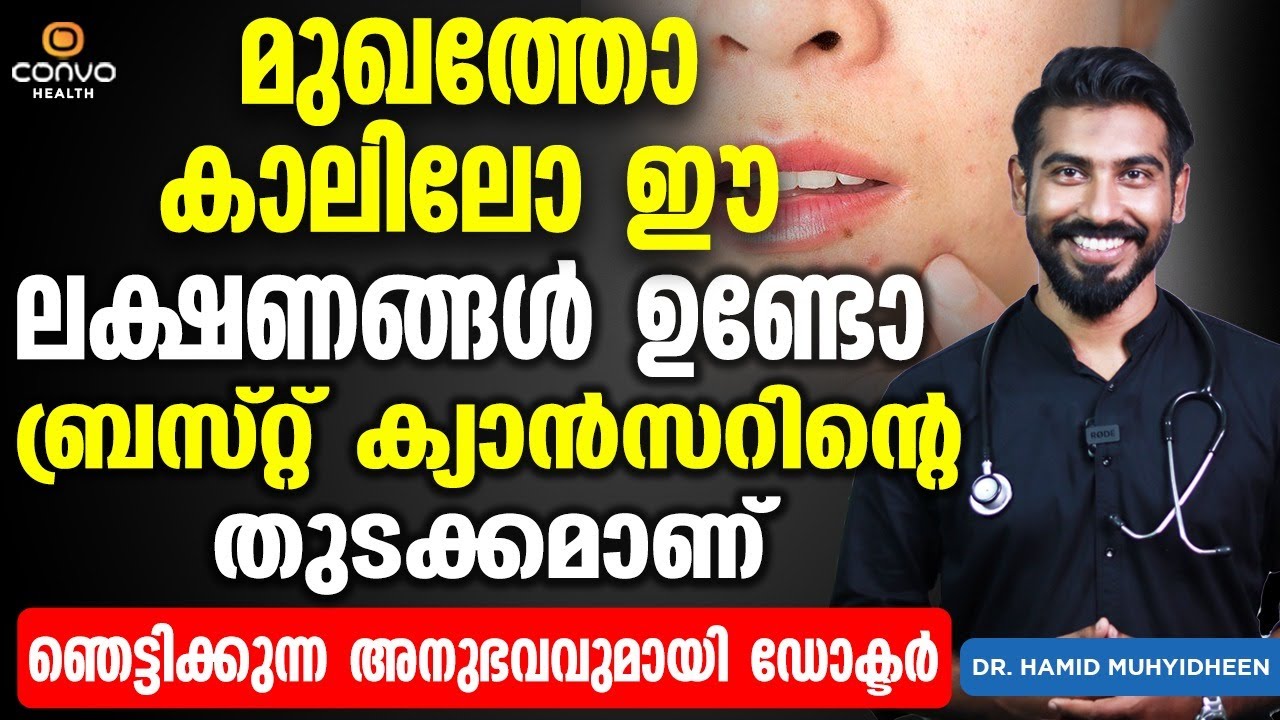 മുഖത്തോ കാലിലോ ഈ ലക്ഷണങ്ങൾ ഉണ്ടോ ബ്രസ്റ്റ് ക്യാൻസറിന്റെ തുടക്കമാണ് | Breast cancer symptoms