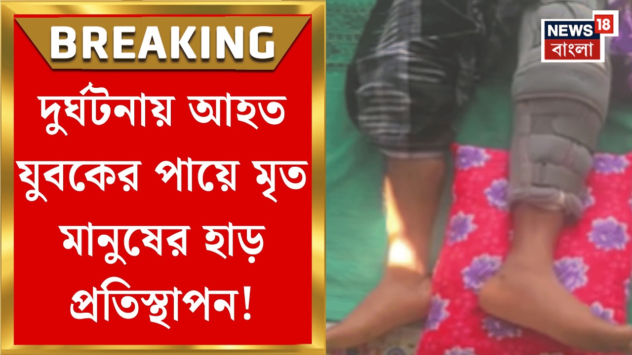 RG Kar News | মৃত মানুষের হাড় অন্যের শরীরে প্রতিস্থাপন, নজির গড়ল আরজি কর | Bangla News