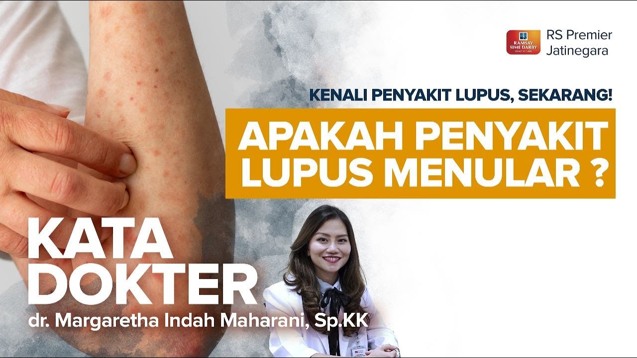Sudah Tahu Penyakit Lupus itu Penyakit Apa? Apakah Menular? Penyakit Lupus adalah Penyakit Autoimun