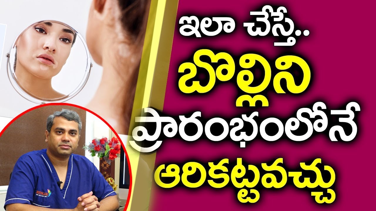 తెల్లబొల్లి సమస్య నివారణ I Bolli Skin Problem I Vitiligo I Health Tips Telugu | Sravya Health