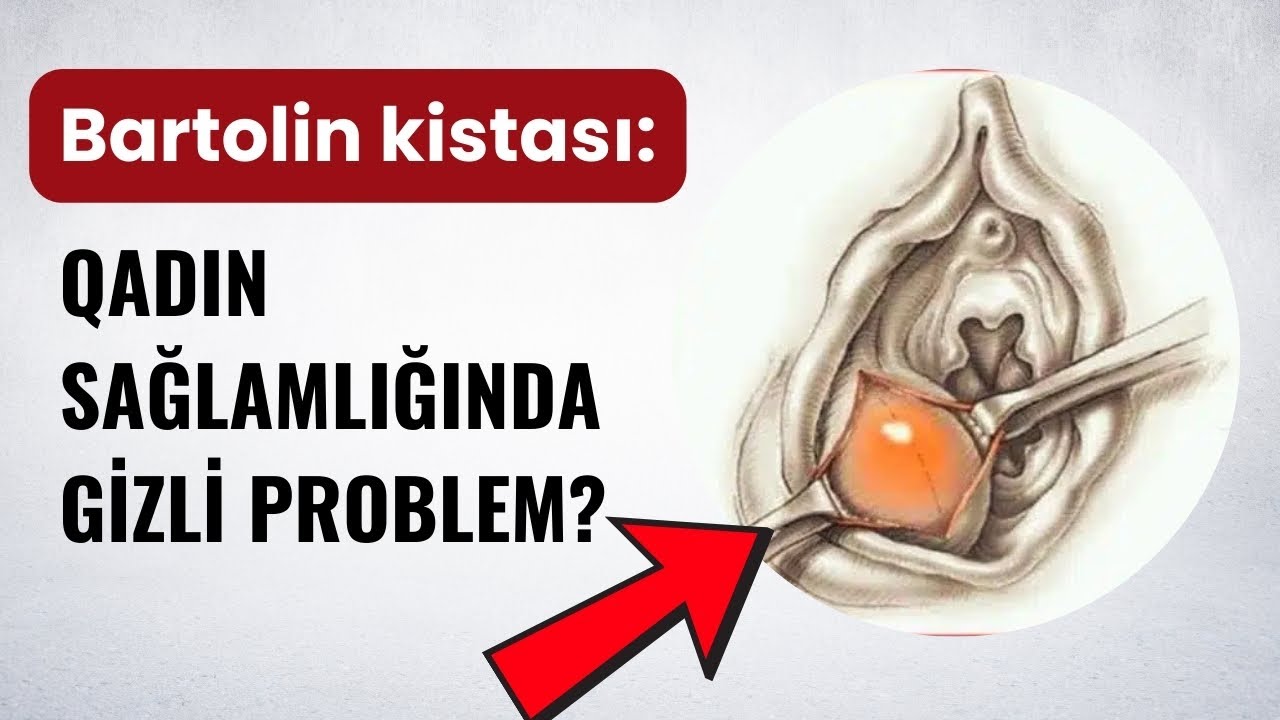 Bartolin Kistası – Nə vaxt narahat olmalısınız?