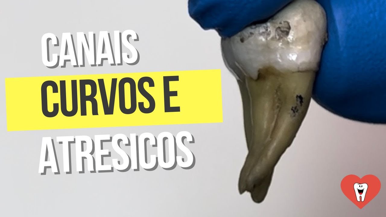 2 PASSOS PARA TRABALHAR CANAIS CURVOS E ATRÉSICOS [ESQUEMATIZADO]