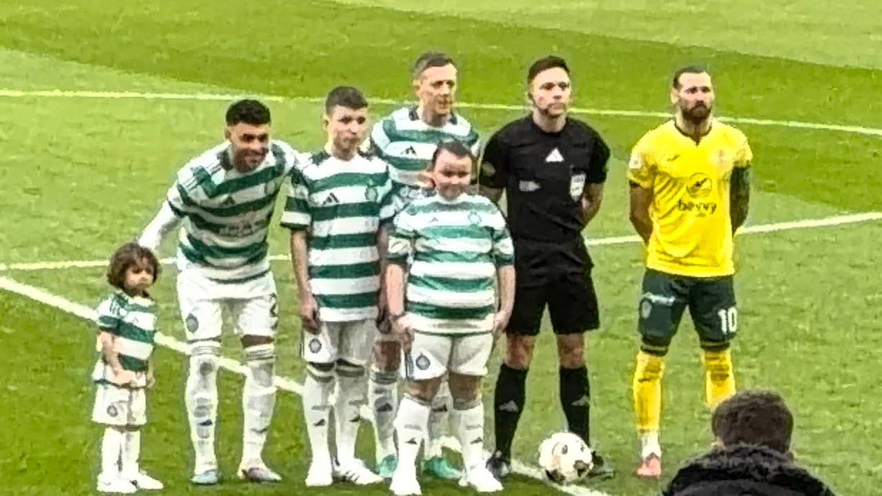 Celtic Vs Hibs 22/2/26 (4K) - Another Defeat As Rangers Draw & Push On In Season Defining Fortnight