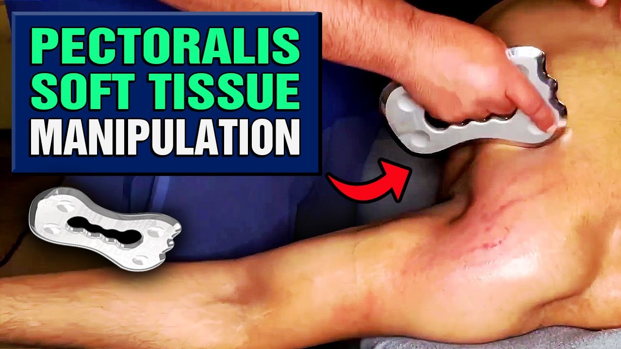 Pectoralis soft tissue manipulation with IATSM Rockblades || Chest Massage || no talking