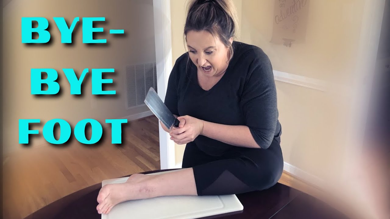 Pre Amputee&rsquo;s Final Goodbye To Foot Before Below The Knee Elective Amputation