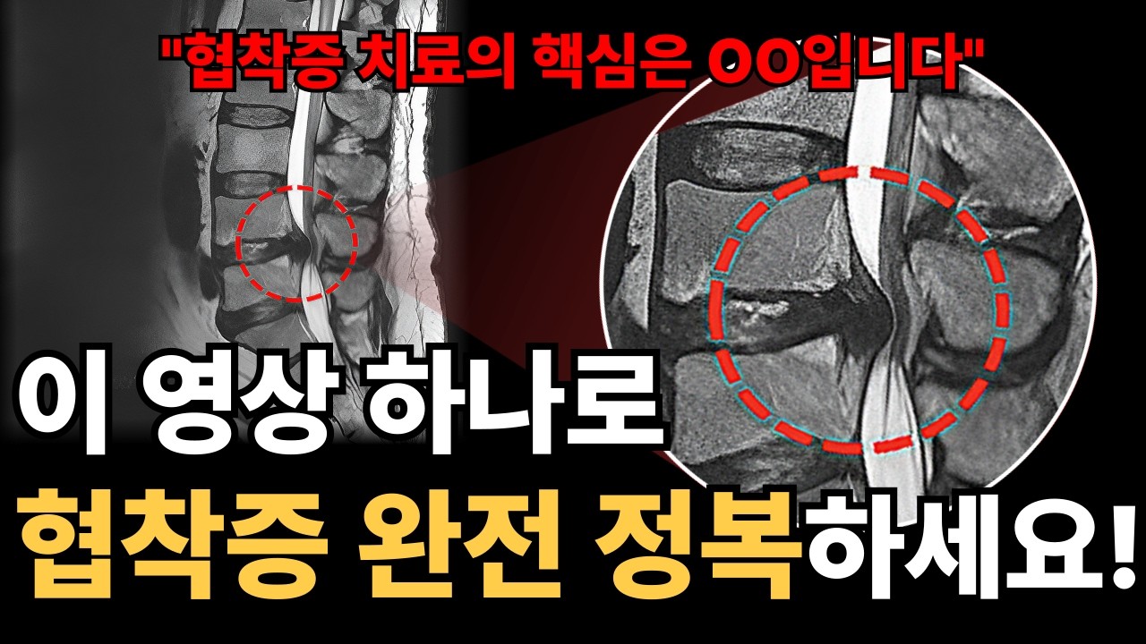 허리통증, 다리저림, 허리협착증 이 영상만 따라하면 허리 평생 쓸 수 있어요