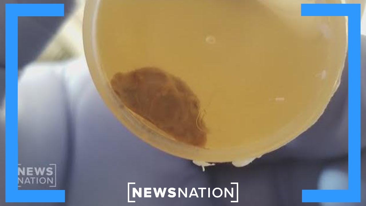 Ex-Pentagon official says VA doctor has seen alien implant
