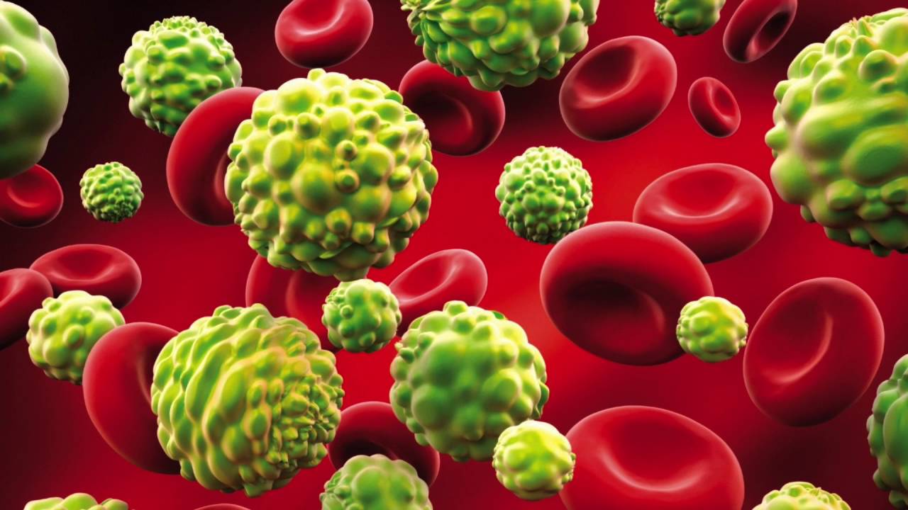 &iquest;Qu&eacute; es el c&aacute;ncer infantil?