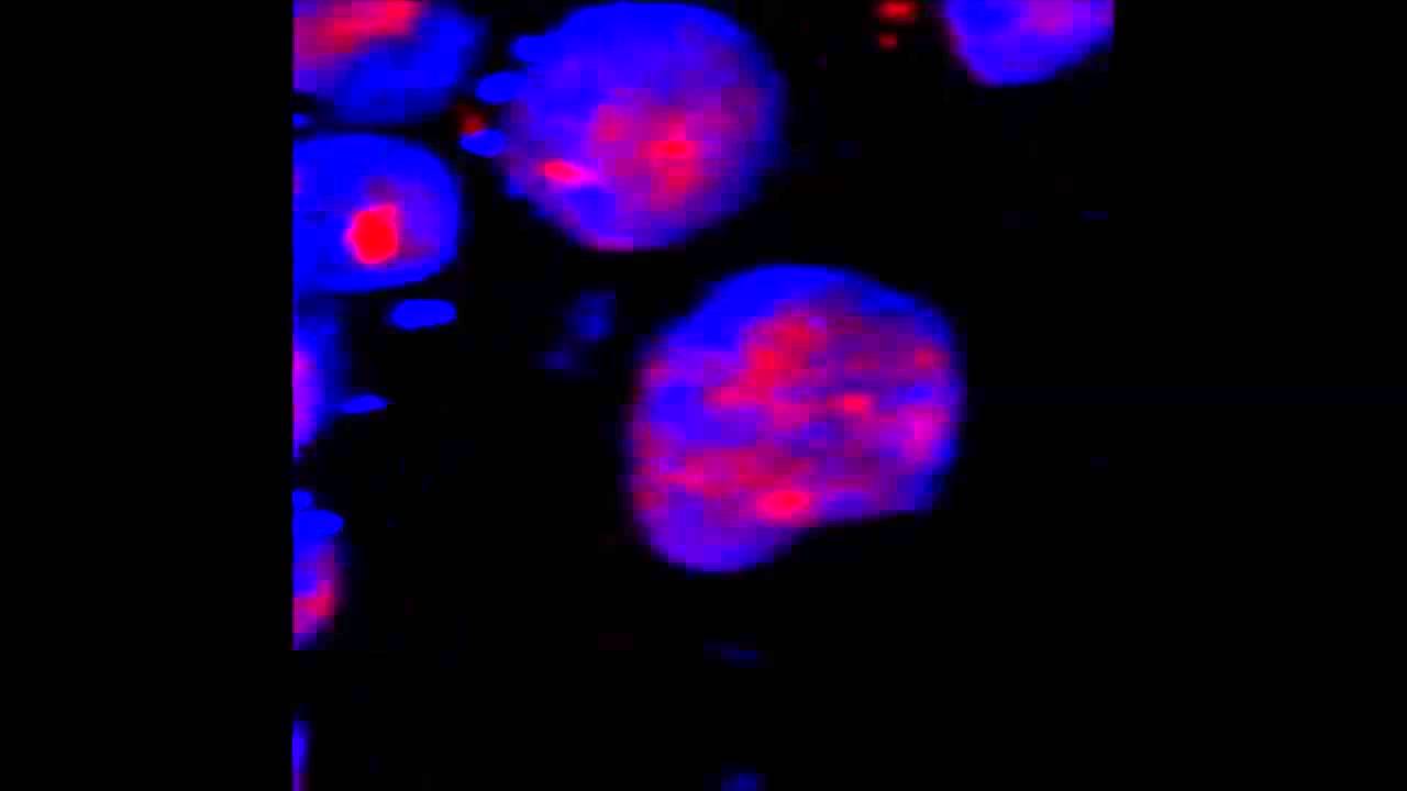 A Ribonucleoprotein Complex Protects the Interleukin-6 mRNA from Degradation by Distinct...