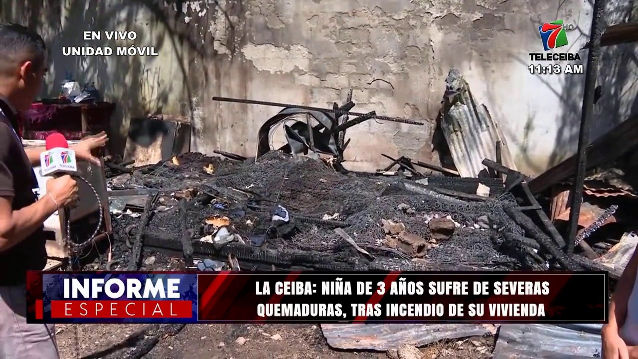 Niña de 3 años sufre de severas quemaduras, tras incendio de su vivienda en La Ceiba, Atlántida