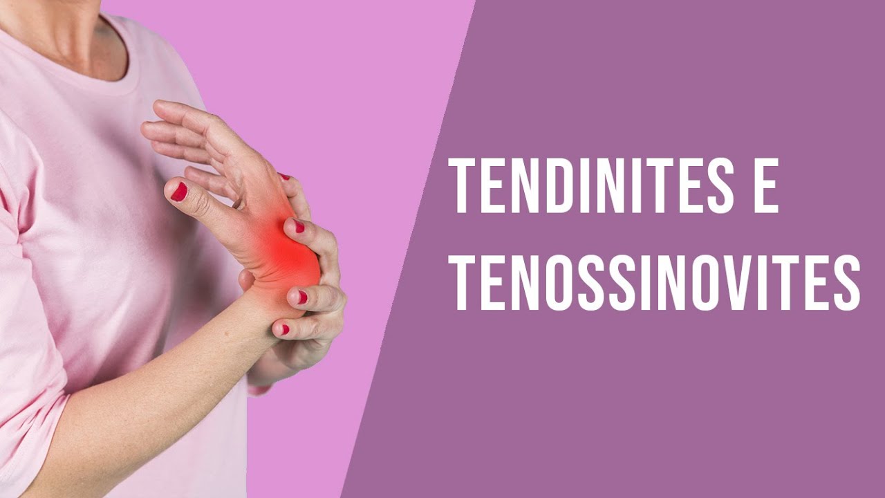 Tendinites e Tenossinovites do Punho e da Mão