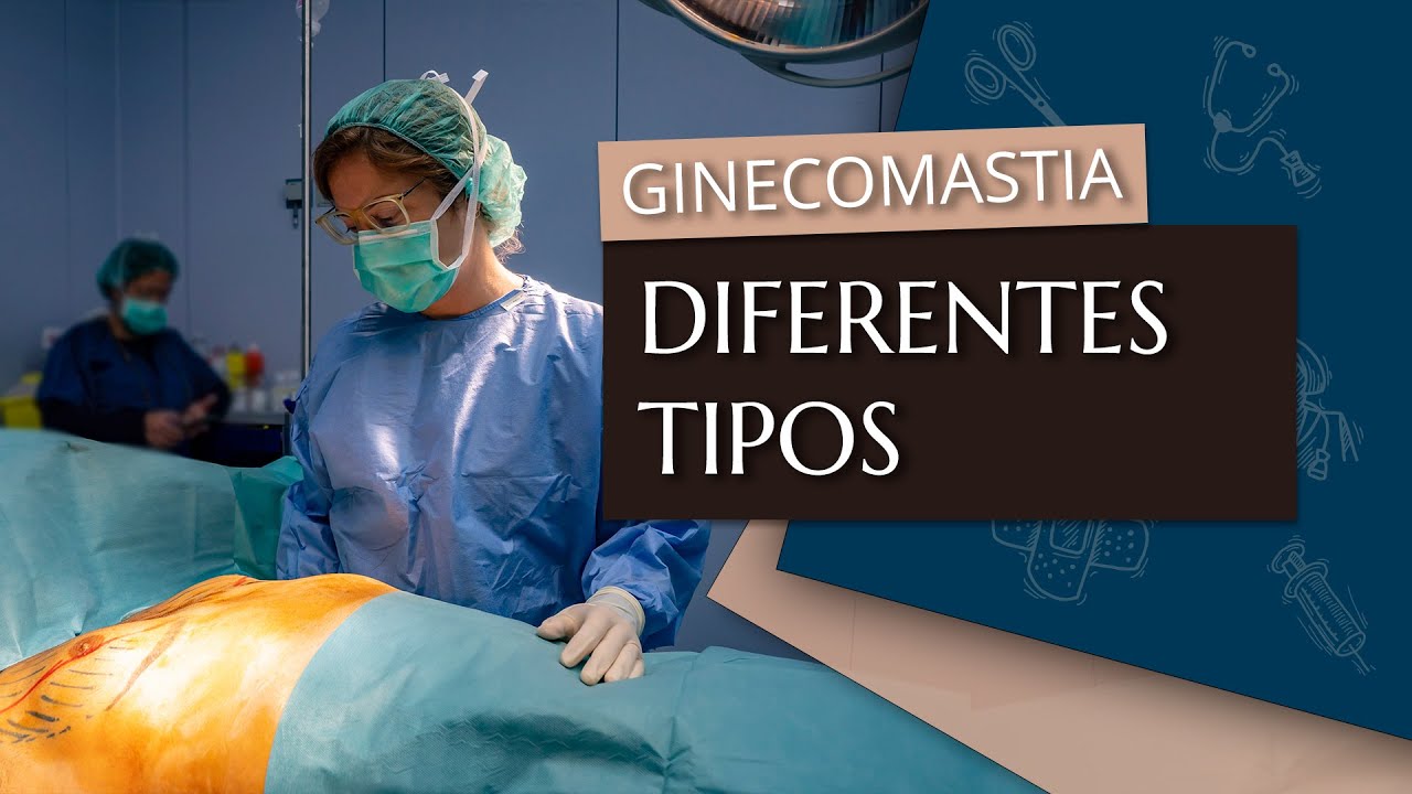 Tipos de ginecomastia