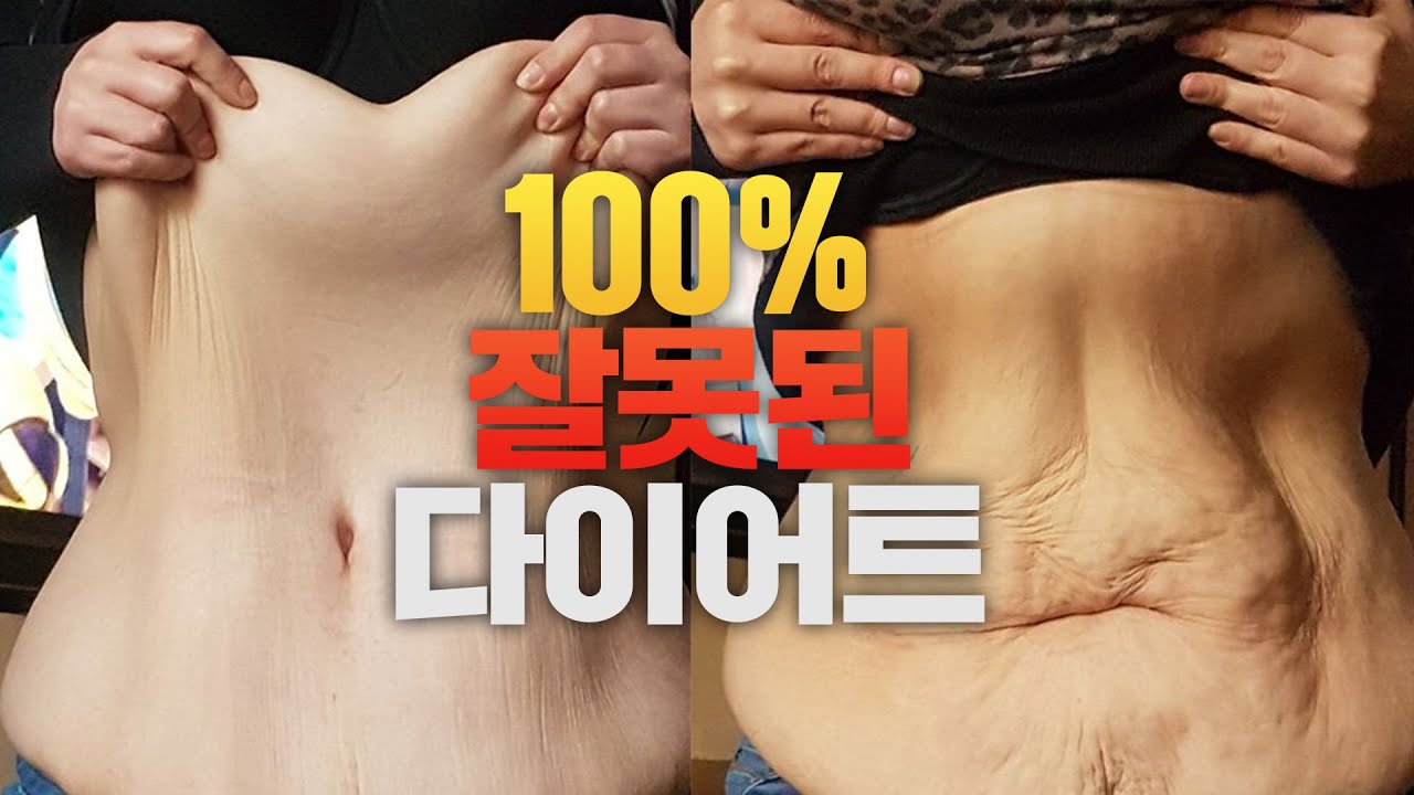 【생리학】 100% 가짜 다이어트 그만❌ 진짜 다이어트는 이렇게 하셔야 합니다