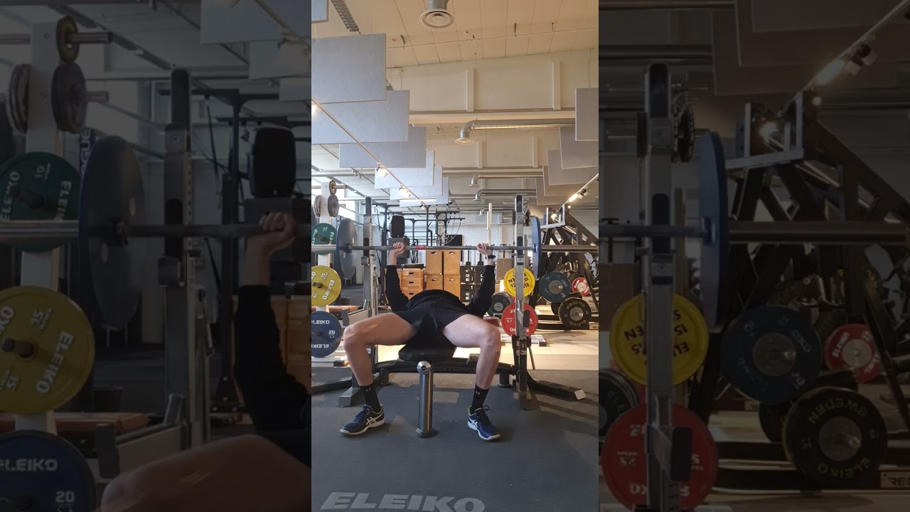 Bära en stomi innebär inte att livet är över 