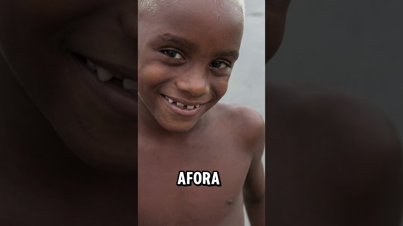 REVELADO COMO ESTA NEGO NEY HOJE EM DIA! - NEGO NEY ATUALMENTE #negoney #funk #fy