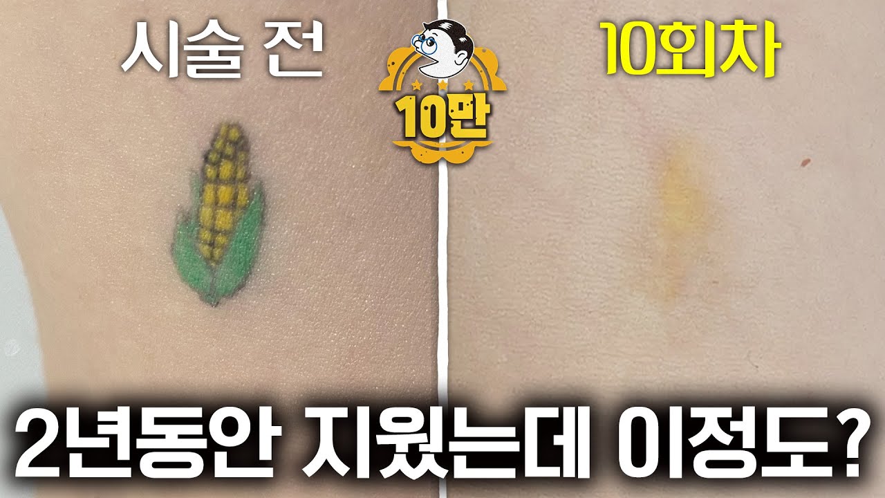 컬러문신을 신중하게 생각해야 하는 이유 보여드릴게요