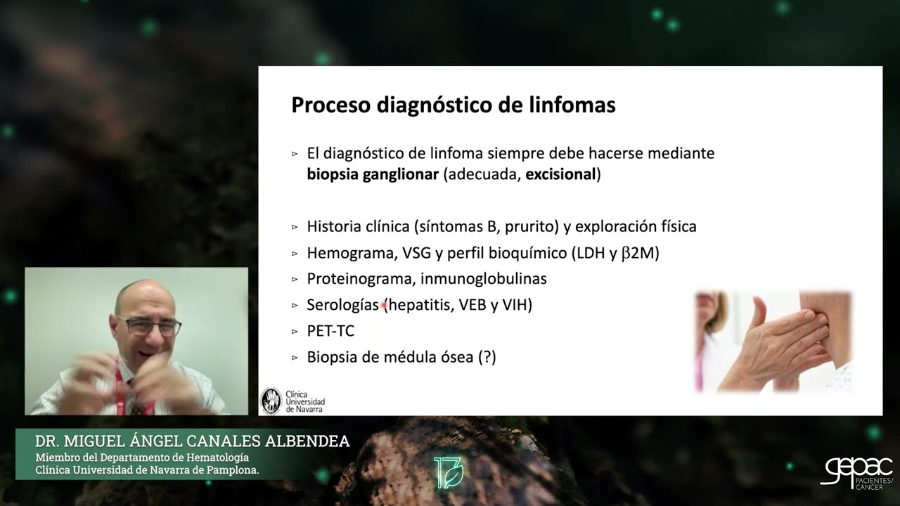 Tratamientos de los linfomas no Hodgkin agresivos: células grandes B - Dr. M. Ángel Canales Albendea