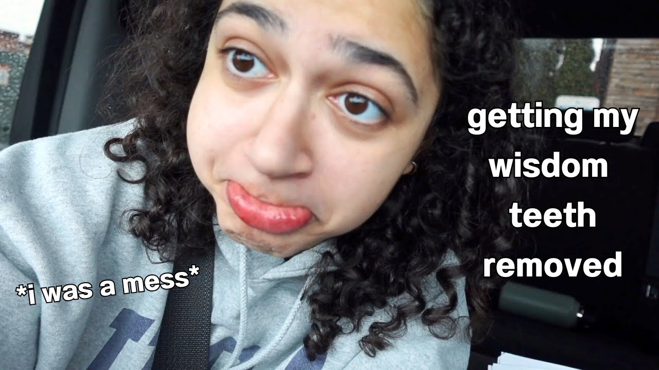 GETTING MY WISDOM TEETH REMOVED *brace yourselves*